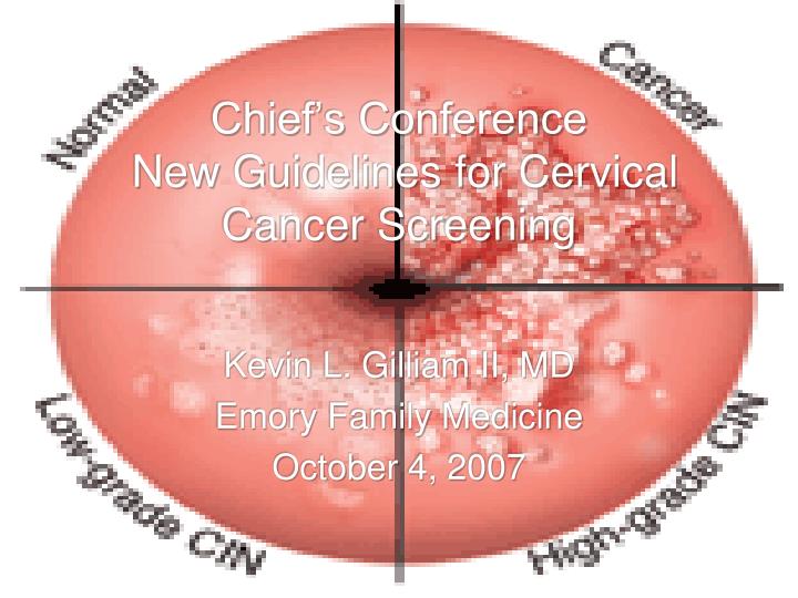 chief s conference new guidelines for cervical cancer screening