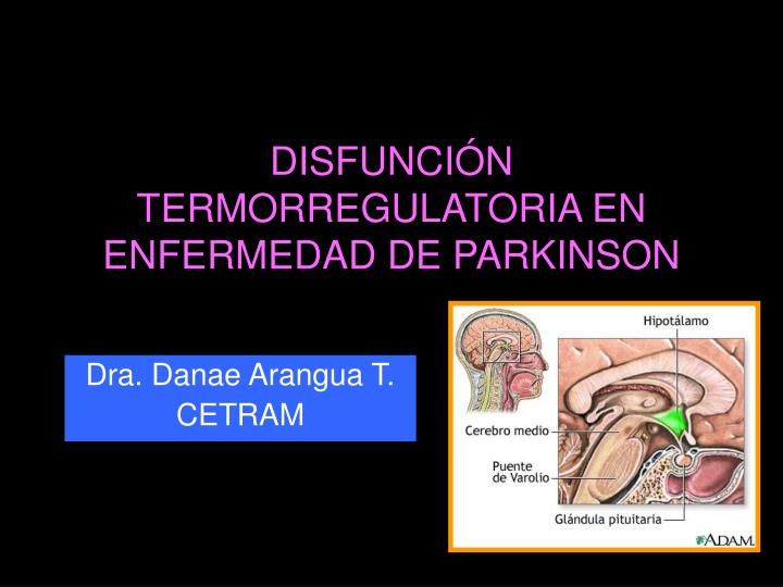 disfunci n termorregulatoria en enfermedad de parkinson