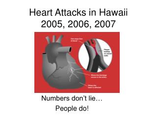 Heart Attacks in Hawaii 2005, 2006, 2007