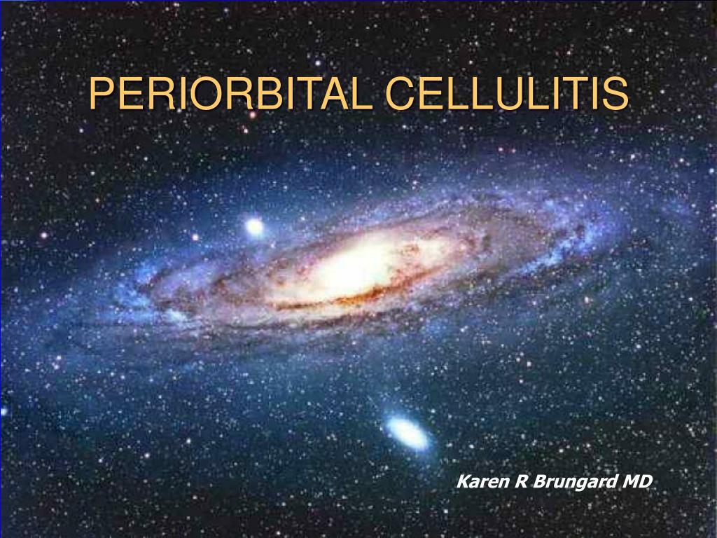 PPT - PERIORBITAL CELLULITIS PowerPoint Presentation, free download ...