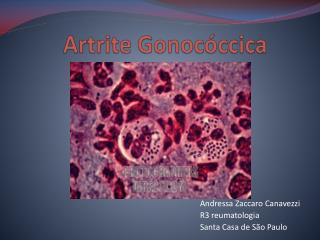 artrite gonoc ccica
