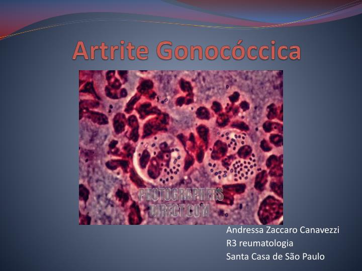 artrite gonoc ccica