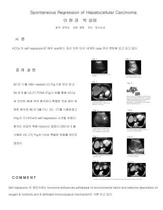 Spontaneous Regression of Hepatocellular Carcinoma