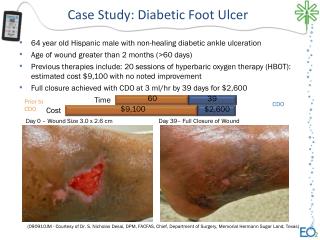 64 year old Hispanic male with non-healing diabetic ankle ulceration