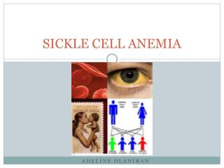 SICKLE CELL ANEMIA