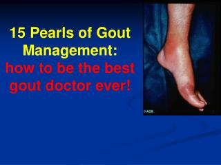 15 Pearls of Gout Management: how to be the best gout doctor ever!