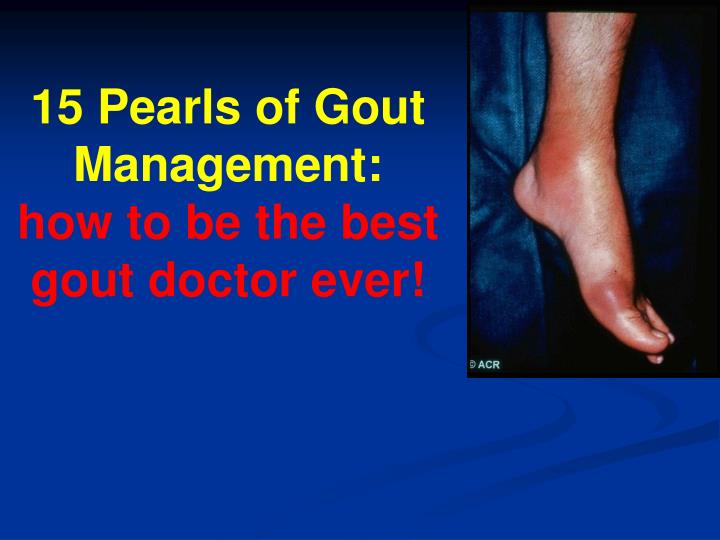 15 pearls of gout management how to be the best gout doctor ever
