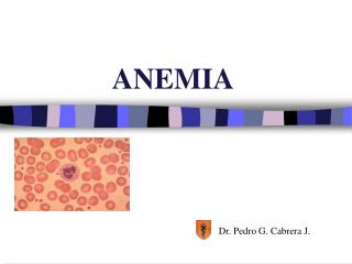 anemia