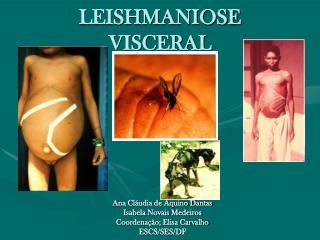 leishmaniose visceral
