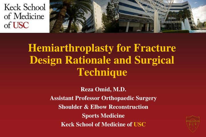 hemiarthroplasty for fracture design rationale and surgical technique