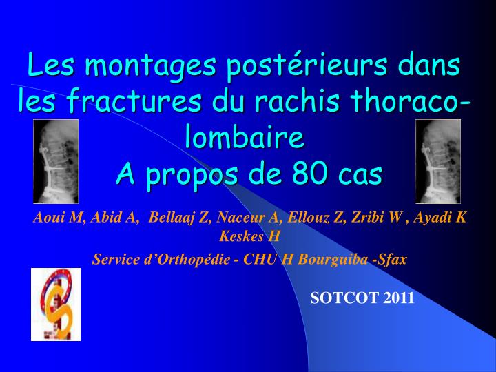 les montages post rieurs dans les fractures du rachis thoraco lombaire a propos de 80 cas