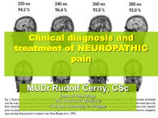 Clinical diagnosis and treatment of NEUROPATHIC pain