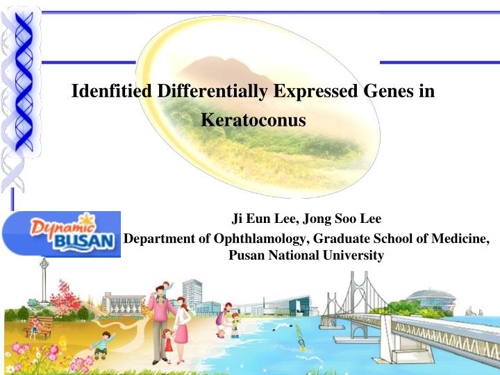 idenfitied differentially expressed genes in keratoconus
