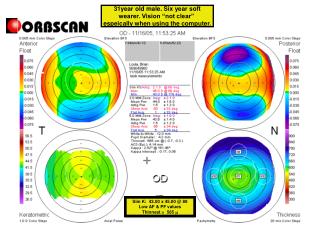 Sim K: 43.00 x 45.00 @ 89 Low AF &amp; PF values Thinnest = 565 ?