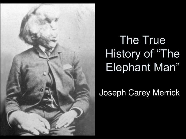 the true history of the elephant man