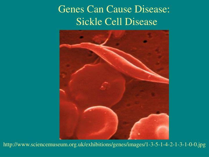 genes can cause disease sickle cell disease