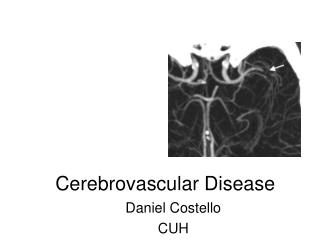 Cerebrovascular Disease