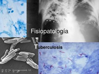 fisiopatol og a