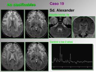 no clasificables