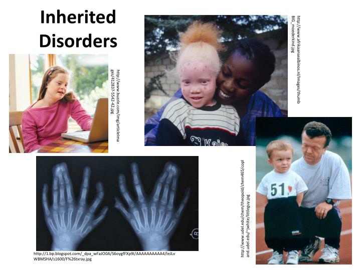 inherited disorders